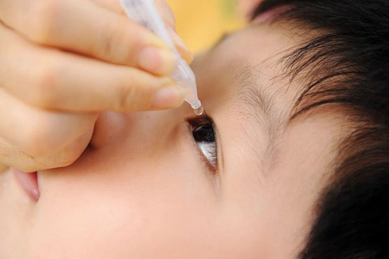 Dịch đau mắt đỏ lây lan rộng, cha mẹ nên làm tốt 5 nguyên tắc này để bảo vệ sức khỏe cho con - Ảnh 1.