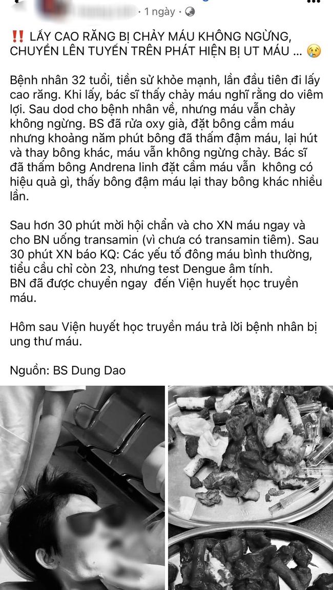 Lần đầu đi lấy cao răng bị chảy máu ồ ạt, bệnh nhân không ngờ bị ung thư máu - Ảnh 1.