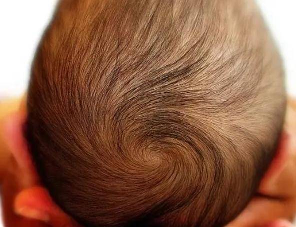 Đứa trẻ có mấy xoáy tóc thì thông minh hơn? Câu trả lời của các nhà khoa học sẽ khiến bạn bất ngờ- Ảnh 1.
